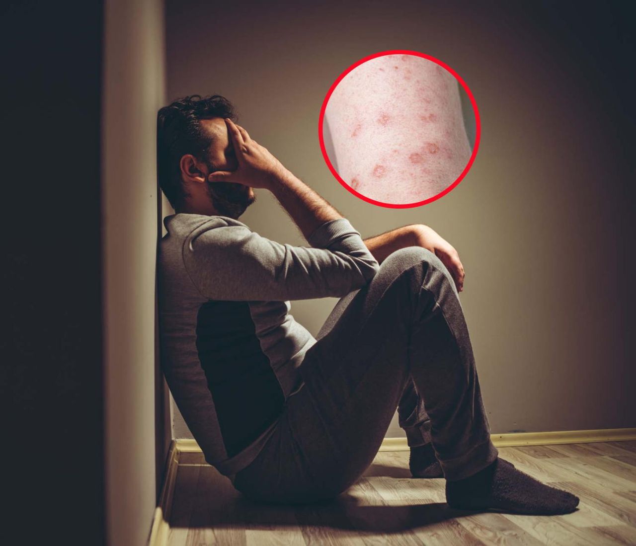 Gwałtowny wzrost zachorowań na choroby weneryczne. Lato działa na ich korzyść