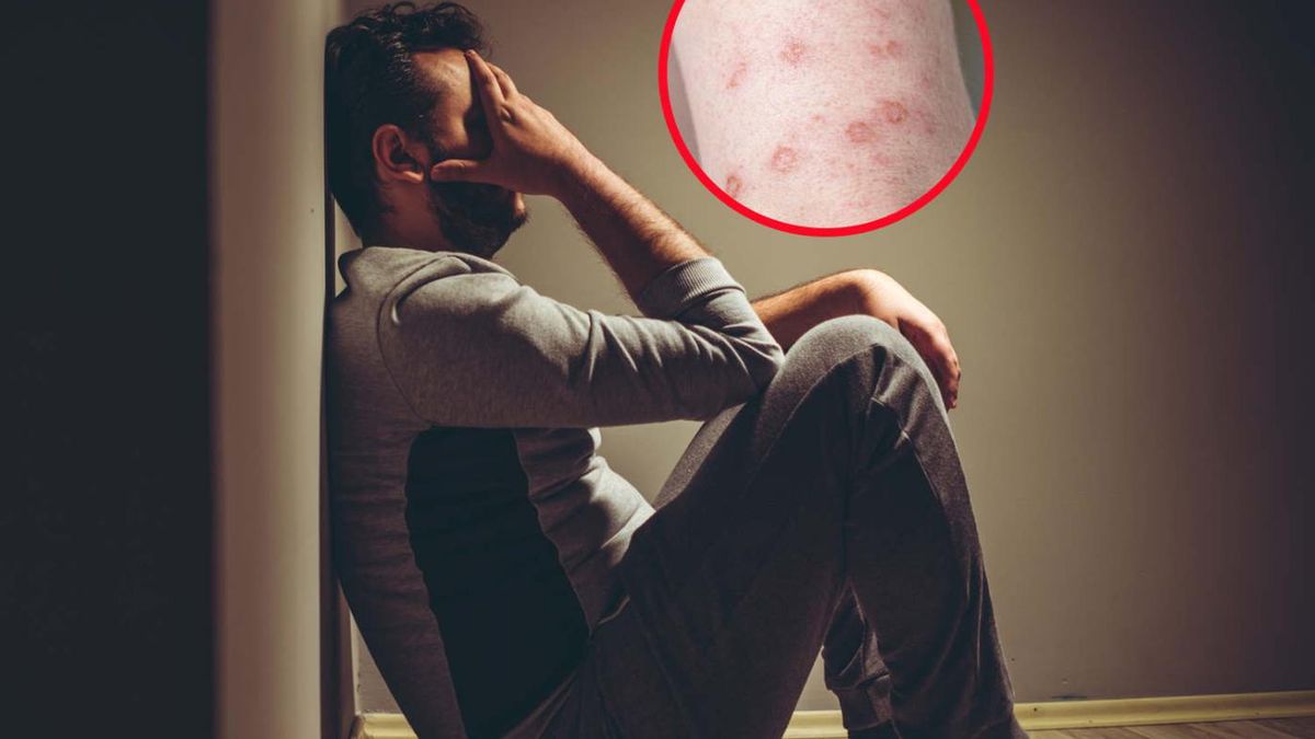 "Liczba zachorowań będzie wzrastać"