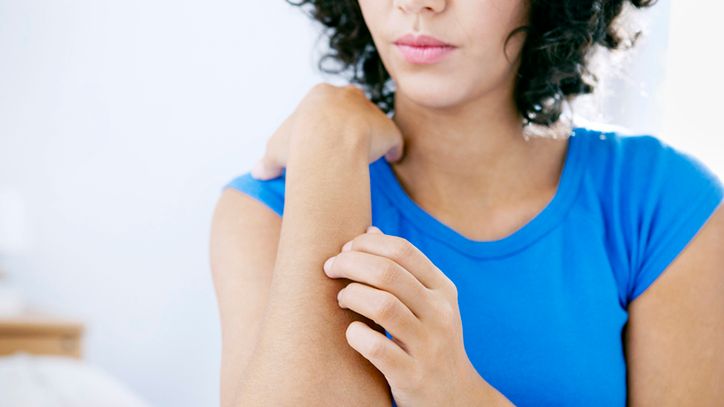 Bąbel pokrzywkowy to wykwit na skórze lub błonie śluzowej.