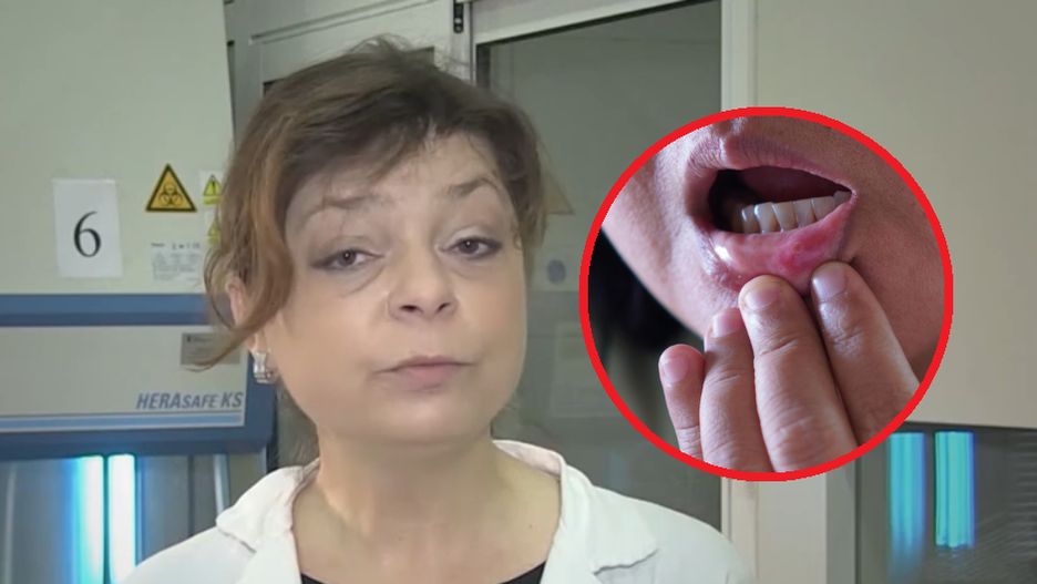 Zakażenie wirusem opryszczki pospolitej może mieć poważne konsekwencje dla kobiet w ciąży i ich noworodków