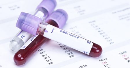 Jakie czynniki mogą zafałszować wyniki badań laboratoryjnych?