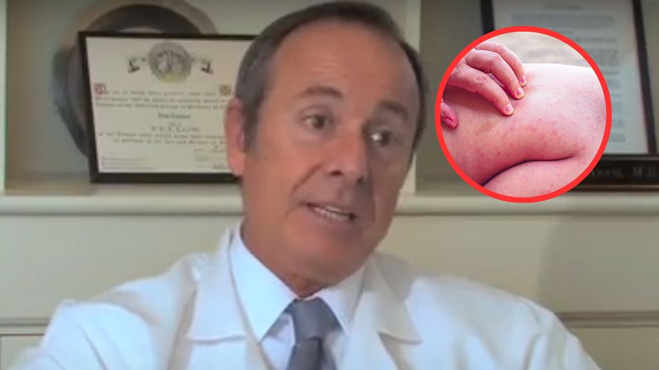 Lekarz zdradza symptomy zakrzepicy. 8 oznak, których nie wolno ignorować