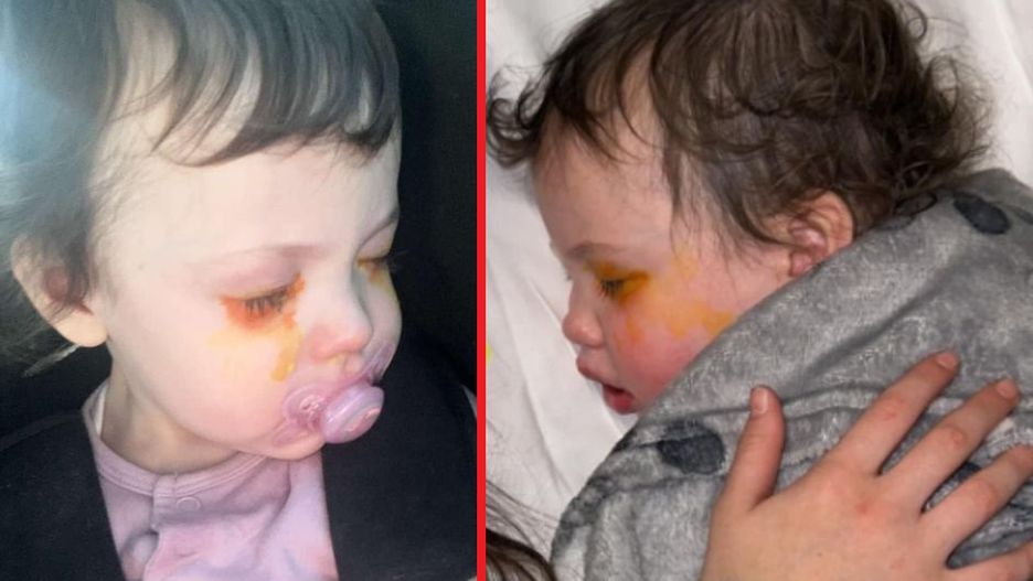 Mama ostrzega przed popularnymi środkami chemicznymi. Jej córka mogła stracić wzrok