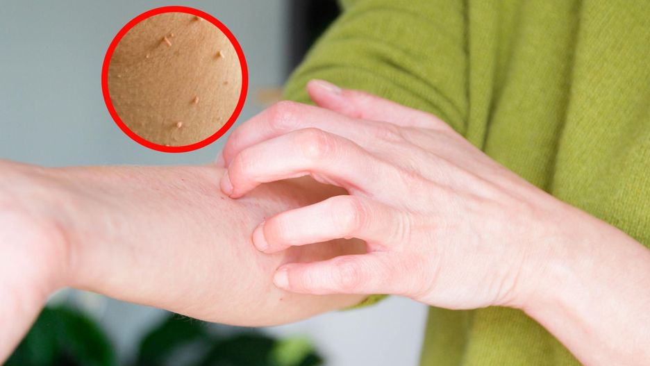 Zauważyłeś na skórze? Naukowcy powiązali z ryzykiem groźnych chorób