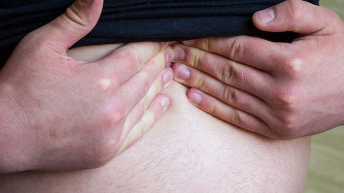 Objawy raka trzustki łatwo je pomylić z innymi dolegliwościami