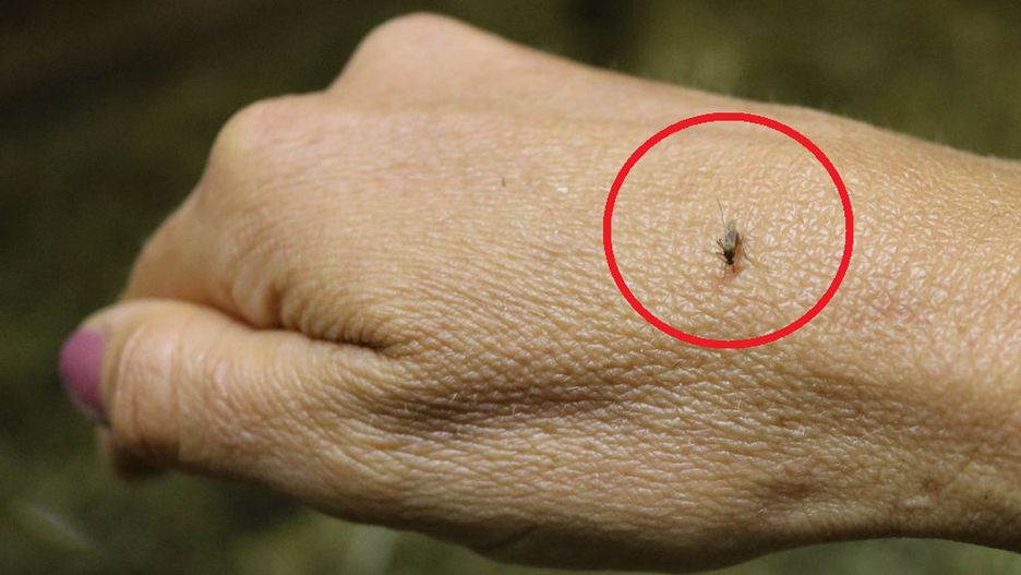 Pojawia się po ukąszeniu przez meszki. Może dojść nawet do wstrząsu anafilaktycznego