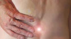 Klawiterapia - co to jest, jak wygląda zabieg klawiterapii, bezpieczeństwo, klawiterapia okiem lekarzy