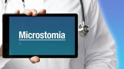 Mikrostomia - charakterystyka, przyczyny, objawy, skutki uboczne