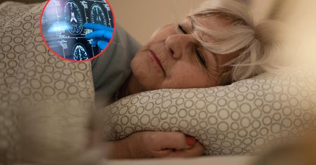Urządzenie z Łodzi stymuluje mózg podczas snu. Przełom w terapii alzheimera