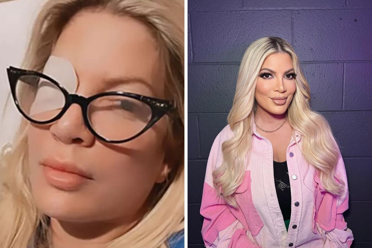Tori Spelling ma problemy ze wzrokiem