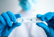 Domowy test na COVID-19. Który wybrać i jakich błędów nie popełniać, aby były wiarygodne?