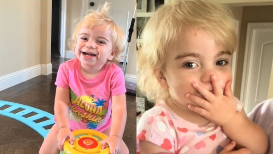 Miała gęste brwi "po tacie". Tak objawiała się nieuleczalna choroba