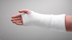 Złamanie - rodzaje, objawy, rozpoznanie i leczenie