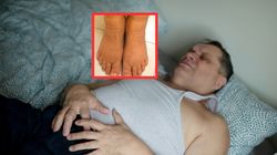 9 mln Polaków ma zniszczoną wątrobę. To nie jest wina alkoholu