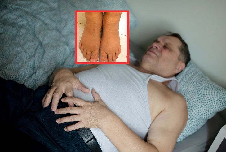 9 mln Polaków ma zniszczoną wątrobę. To nie jest wina alkoholu