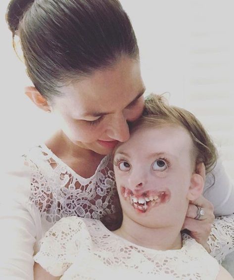 Sophie Weaver cierpiała na zespół Retta