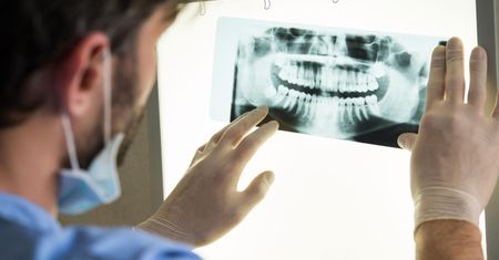 Choroby wywoływane przez próchnicę. Nie jest to tylko problem zębów