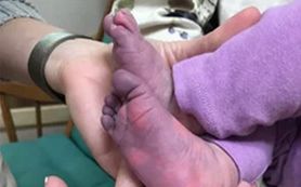Blue COVID. Matka pokazała niemowlę z "covidowymi palcami"