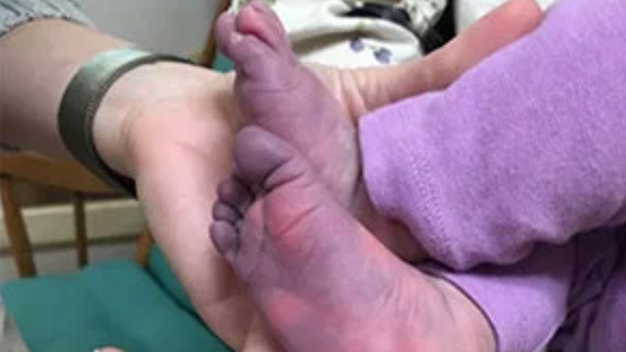 Nóżki dziecka były sine