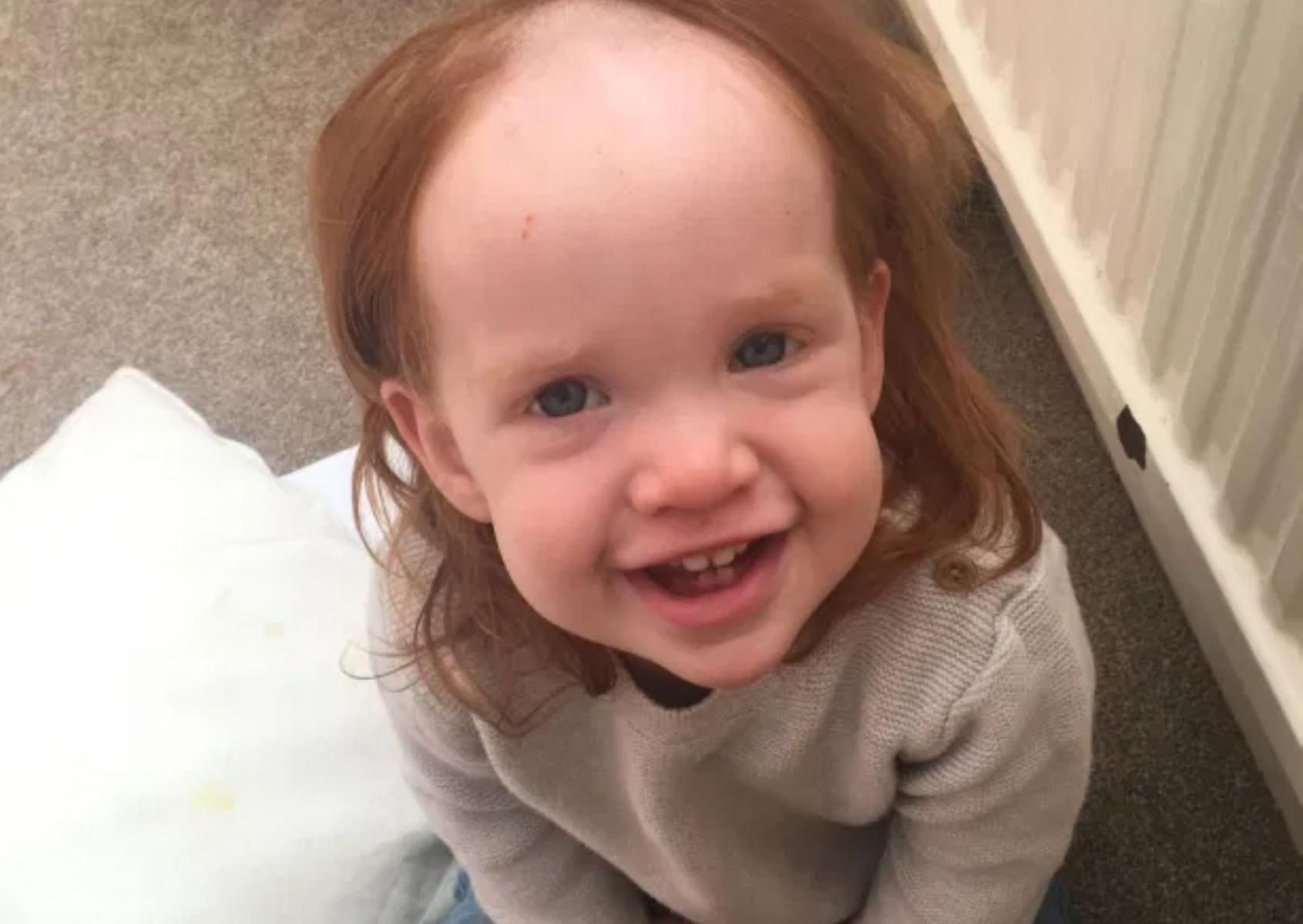 Niemowlę posmarowało sobie głowę kremem do depilacji