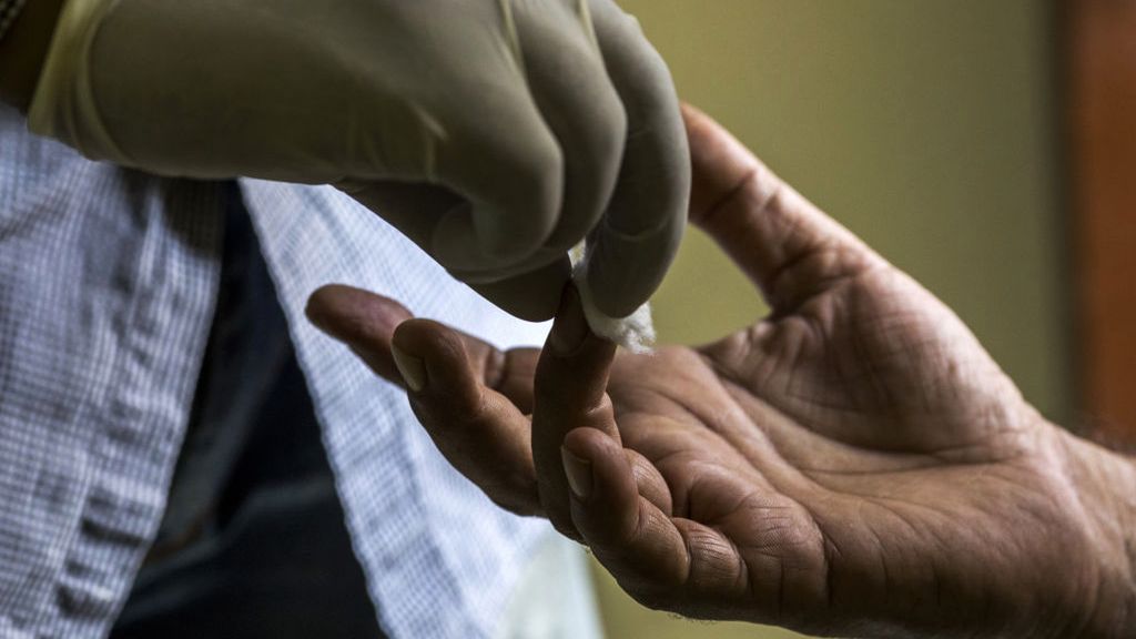 Gdy stłuszczenie wątroby prowadzi do cukrzycy. Naukowcy odkryli, jak wpłynąć na poziom insuliny we krwi i opanować przyrost masy ciała