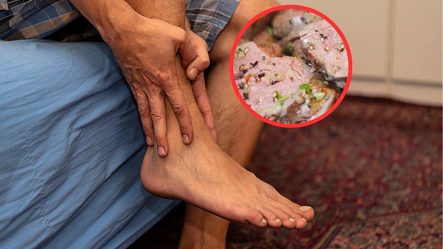 "Chorobę królów" poznasz po silnym bólu. Najlepszym ratunkiem jest dieta