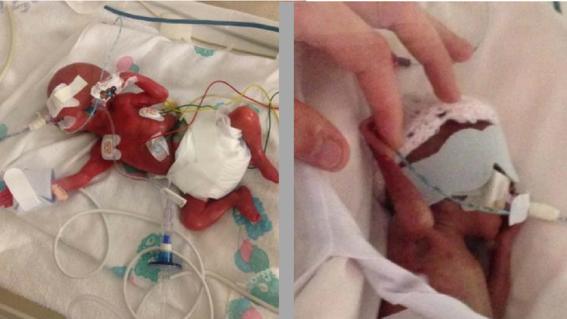 Najmłodsze bliźniaki w Wielkiej Brytanii