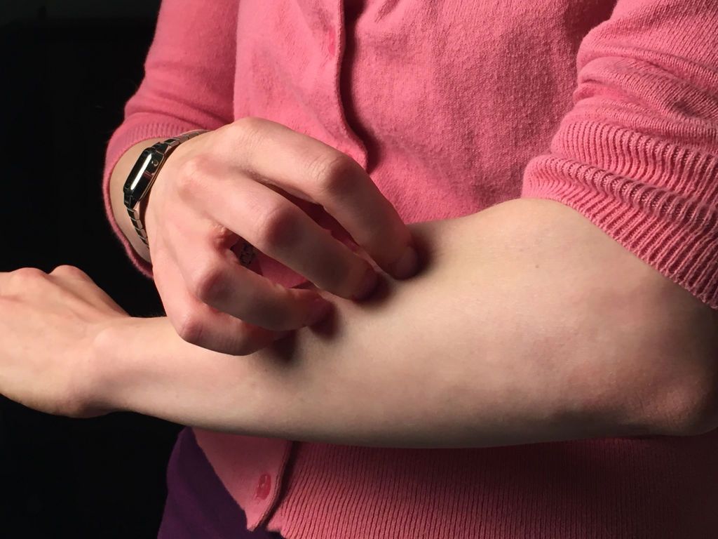 Swędzenie skóry, które trwa powyżej kilku tygodni, może być związane m.in. z rozwojem raka trzustki i wątroby 