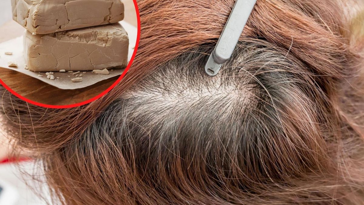 Naturalne metody, które pozwolą ci zatrzymać nadmierne wypadanie włosów