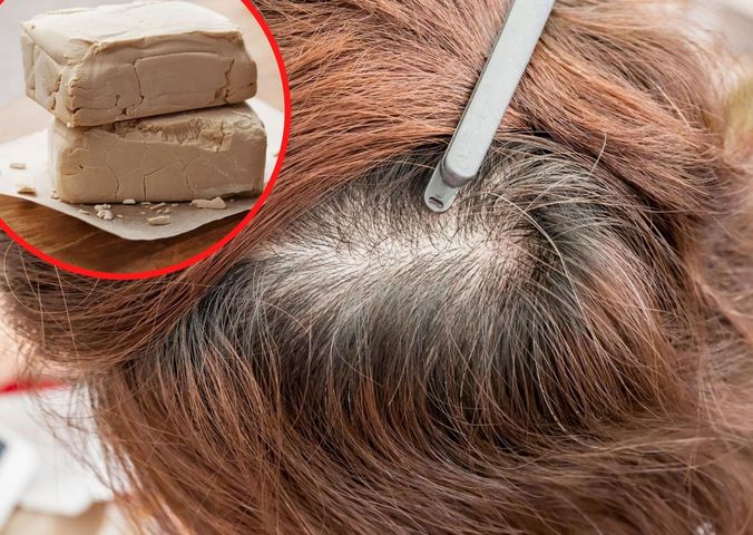 Naturalne metody, które pozwolą ci zatrzymać nadmierne wypadanie włosów
