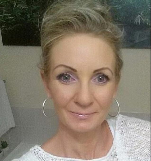 Deborah zmaga się teraz z poważnymi ranami, które przykrywa tylko mocny makijaż