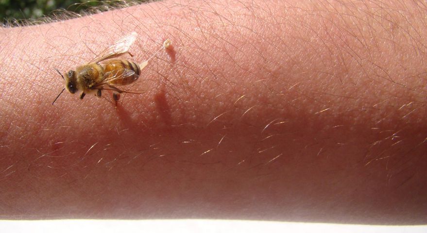 Dla osób uczulonych ukąszenie niektórych owadów może być groźne