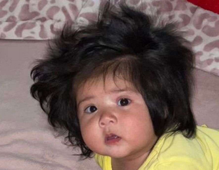 To niewiarygodne, jak gęste włosy ma dziewczynka