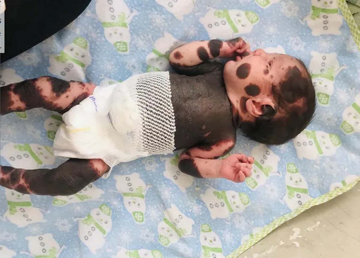 Lekarze proponowali, by porzucili synka. Tak dzisiaj wygląda dziecko panda