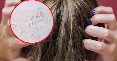 Powoduje problemy neurologiczne, biegunkę, bóle głowy. Sprawdź mieszkanie