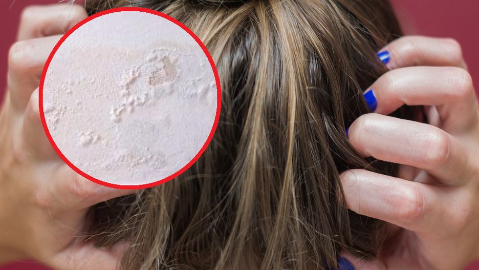 Powoli podkrada zdrowie w domu. Dzieci są szczególnie podatne