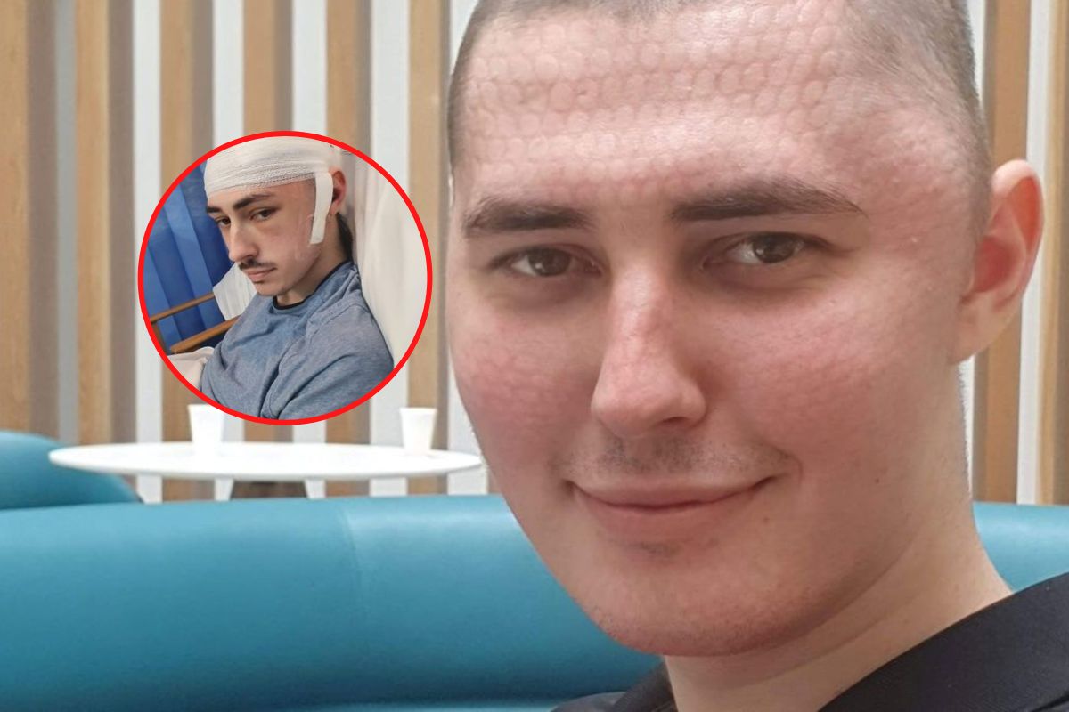 Lekarz zalecił leki przeciwbólowe. 23-latek ma guza mózgu wielkości grejpfruta