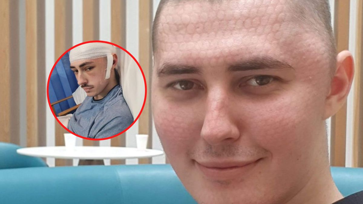 Przez dwa miesiące cierpiał z powodu bólu głowy oraz nudności