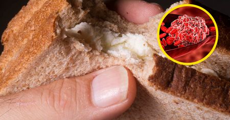 Polacy je kochają. Pierwszy krok do zakrzepicy