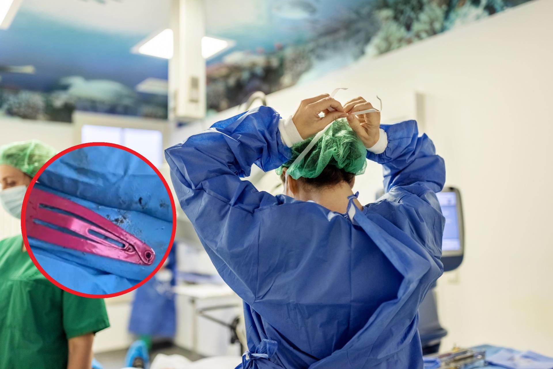 Nietypowy przedmiot usunięty z żołądka dziecka