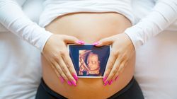 Płód arlekin - przyczyny, objawy, diagnostyka i leczenie