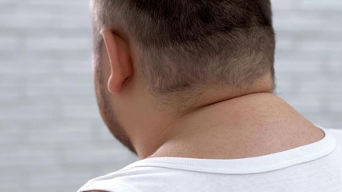 Wdowi garb. Jakie są objawy i przyczyny schorzenia?