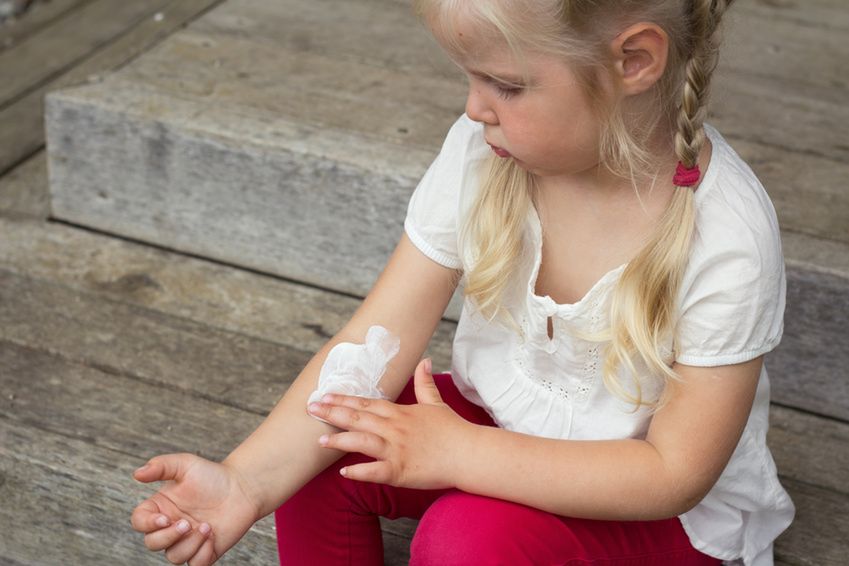 Objawy atopowego zapalenia skóry u dzieci powyżej 2. roku życia