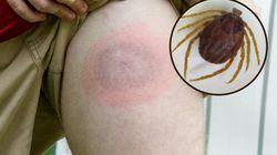 Groźne kleszcze w Niemczech. Hyalomma mogą przenosić gorączkę krwotoczną