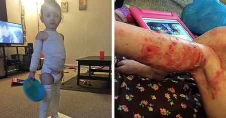 Rodzice narażają życie 3-letniej córki na niebezpieczeństwo. Wszystko po to, aby mogła być zdrowa. Nazywają ją "małą mumią"