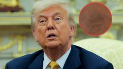 Ta choroba dotknęła Donalda Trumpa. Objawy mogą zaostrzać się w czasie upałów