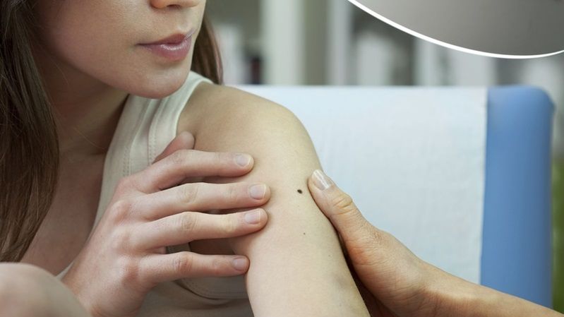 Blizny powstają na skutek różnych urazów, a także często są pamiątką po zabiegu operacyjnym