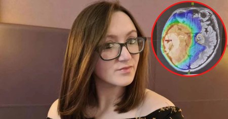 Myślała, że to kac. Guz mózgu przez długi czas dawał nietypowe symptomy