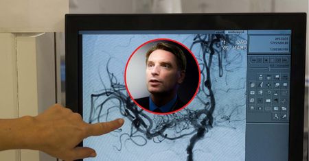 Tomasz Lis przeszedł czwarty udar. Neurolog: To jedna z najbardziej przerażających przypadłości