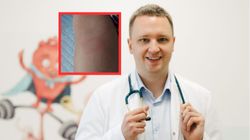 Pomylili objawy z uczuleniem. "Krętki boreliozy rozsiały się"